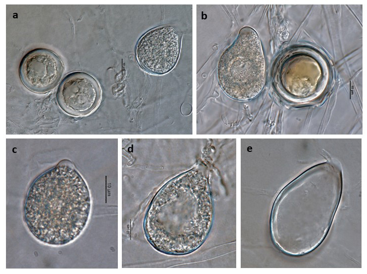 Phytophthora acerina (CPHST BL 114, ex-type) asexual phase and sexual phase (a-b);nbsp;different shapes of semi-papillatenbsp;persistent sporangia (a-e);nbsp;photos by G. Abad, USDA-APHIS-PPQ